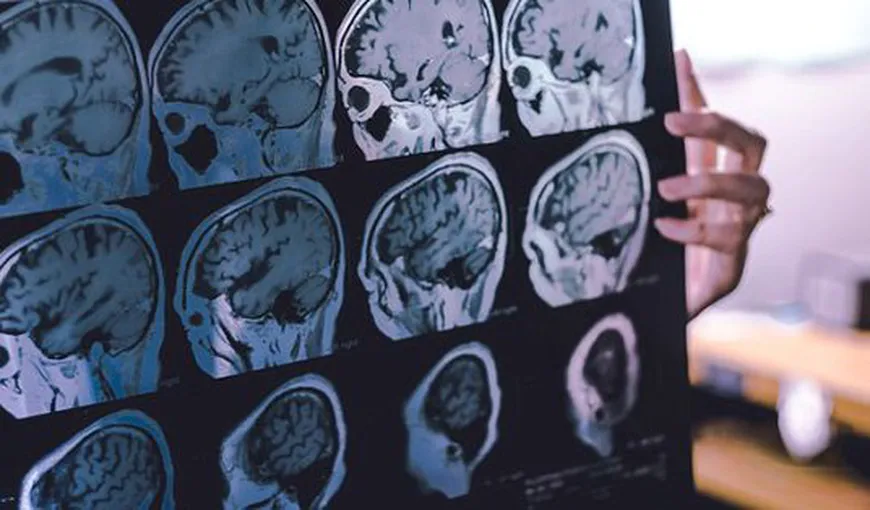 Oamenii de ştiinţă vor redefinirea bolii Alzheimer. Companiile farmaceutice ar urma să-şi modifice aria de acţiune împotriva maladiei