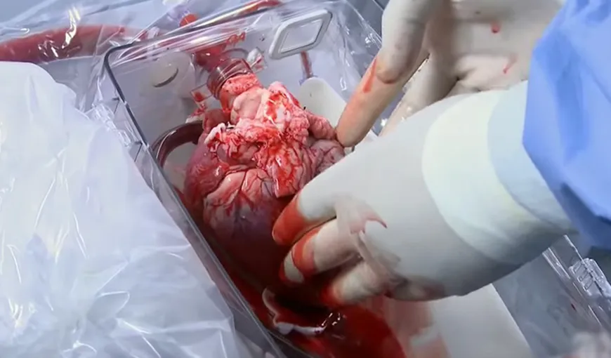 Primul transplant de cord din acest an, realizat la Târgu Mureş. Operaţia a durat aproape şase ore