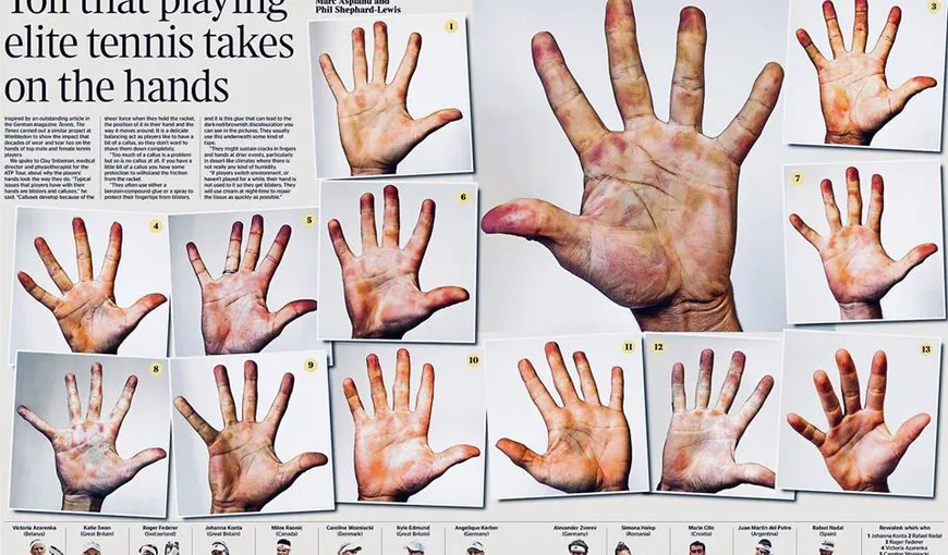 Aşa arată mâinile campionilor din tenis. Ghiceşte care sunt ale Simonei Halep!