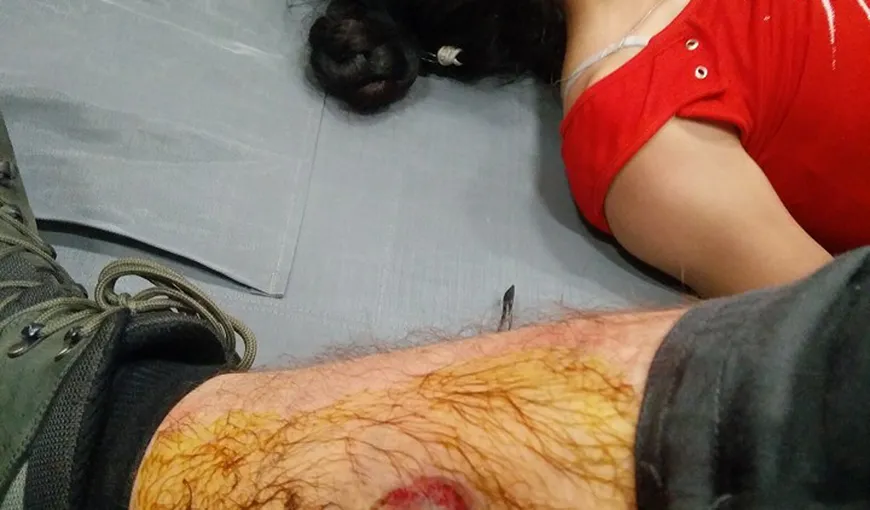Protestatarul rănit grav la manifestaţiile din 10 august vrea să emigreze