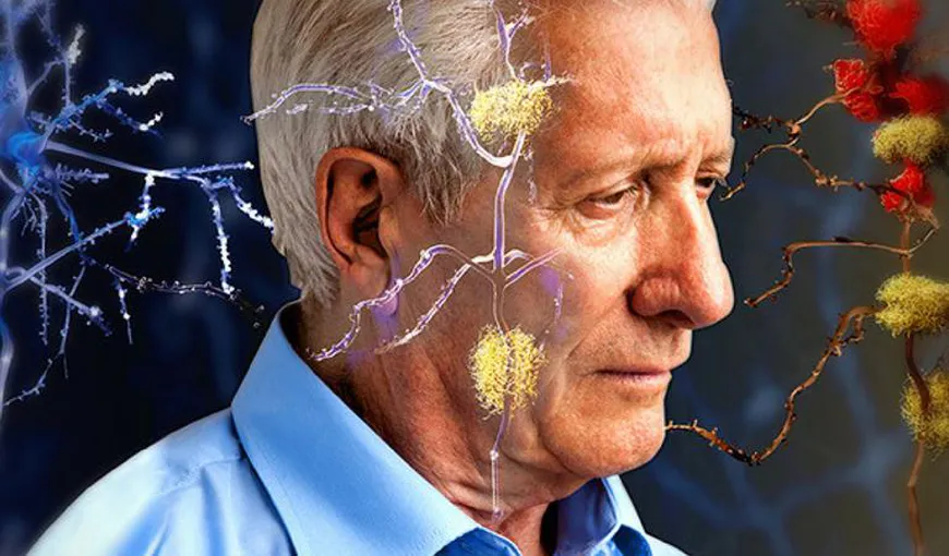 Studiu: Un dezechilibru al pH-ului din creier poate provoca Alzheimer