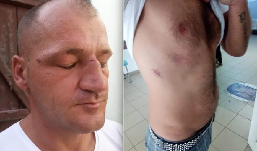 Poliţişti acuzaţi că au bătut un bărbat, în Sibiu. Se face anchetă