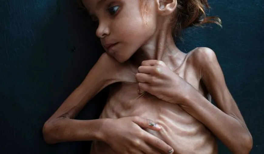 Fetiţa de 7 ani care a devenit simbolul crizei umanitare din Yemen s-a stins din viaţă