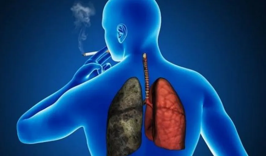 STUDIU: Cancerul pulmonar, mai frecvent printre nefumători decât se crede