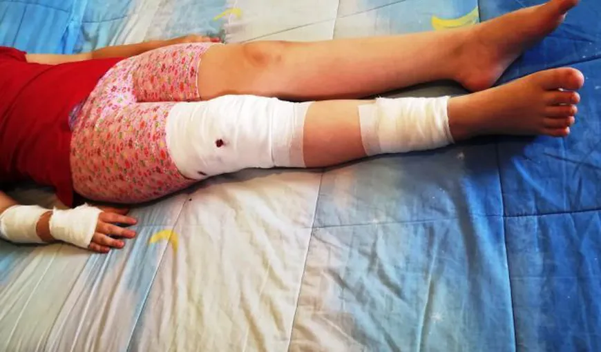 O fetiţă de 10 ani a fost sfâşiată de un maidanez. Micuţa îi dăduse restul de sandwich rămas de la şcoală FOTO