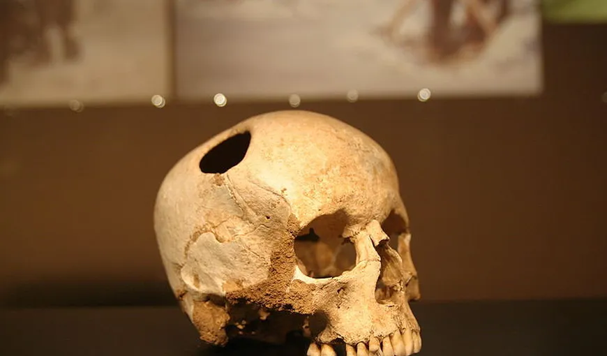 Prima crimă de pe teritoriul României a avut loc în urmă cu 30.000 de ani. Victima a fost descoperită la Cioclovina