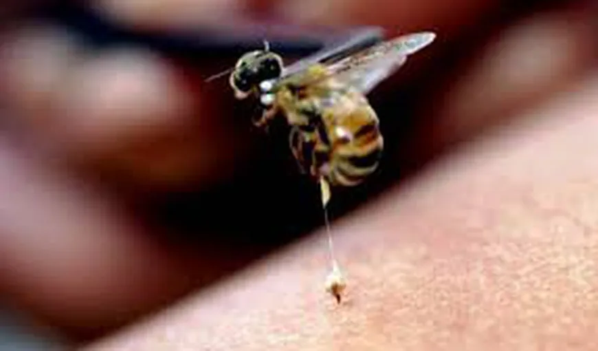 Intepaturile de albine si viespi la copii. Ce faci imediat după înţepătură