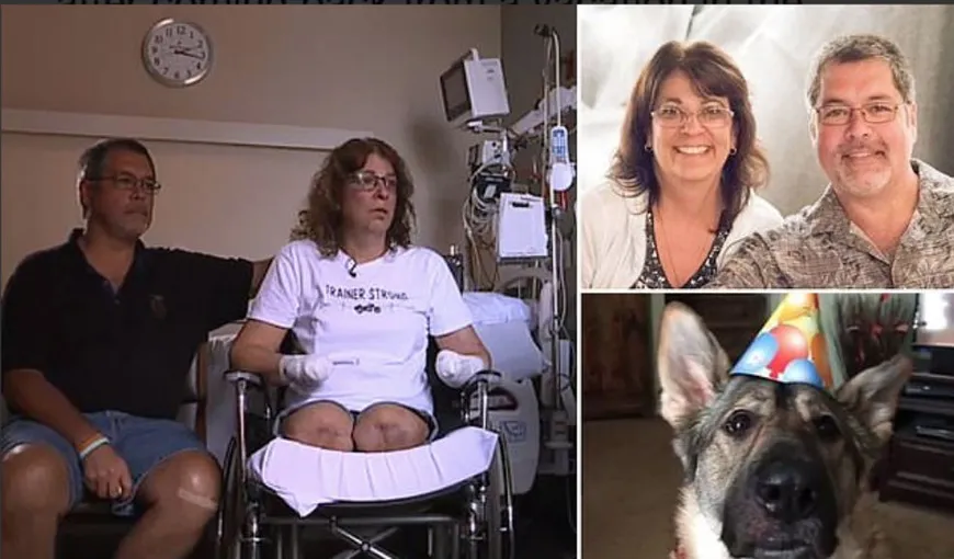 O femeie a rămas fără mâini şi picioare după ce câinele ei i-a lins o rană, transmiţându-i astfel o bacterie periculoasă