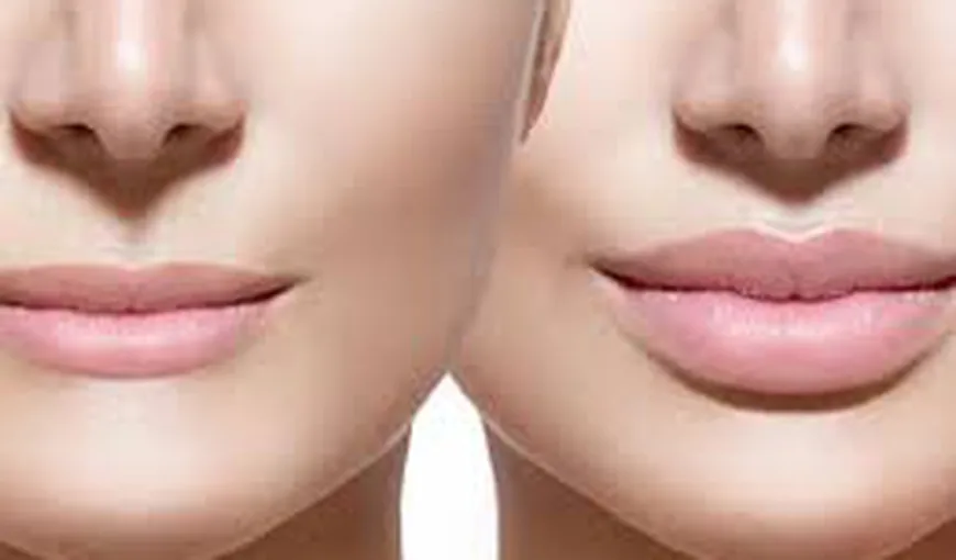 Măriri de buze şi proceduri de înfrumuseţare, efectuate ilegal în Suceava de o clinică din Capitală
