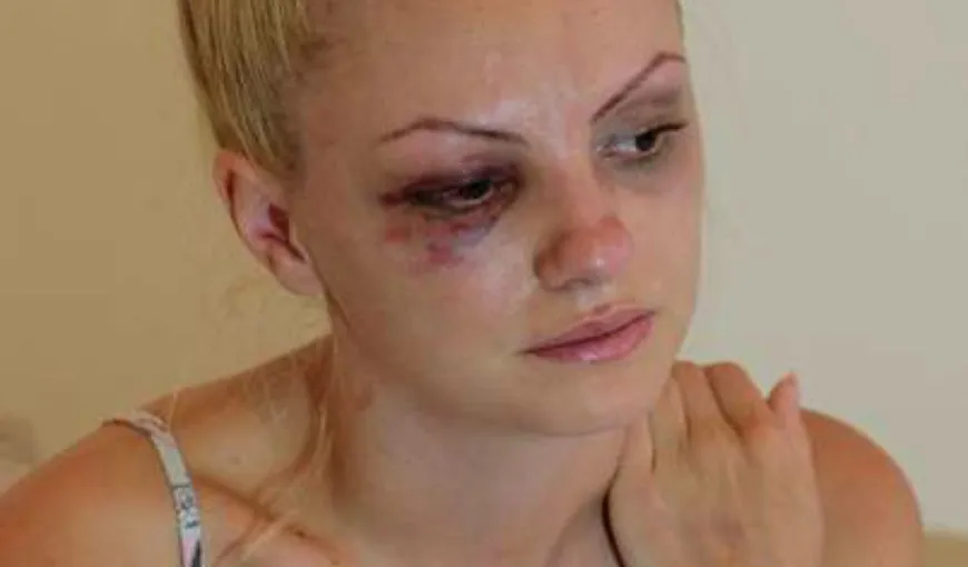 Alexandra Stan, desfigurată! Dezvăluiri-şoc despre bătaia încasată acum şase ani