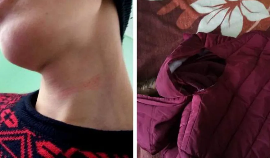 Elev agresat de profesor, la un liceu din Botoşani: „L-a făcut prost şi dobitoc, i-a rupt geaca şi l-a zgâriat pe gât!”