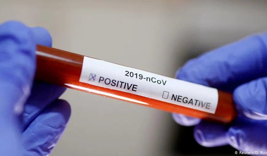 Număr record de infectări cu coronavirus în România. Câte teste au fost prelucrate în ultimele 24 de ore