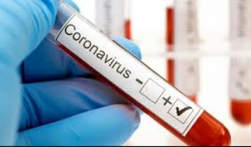 De ce se răspândeşte noul coronavirus atât de repede. Virusul COVID-19 e de 1.000 de ori mai periculos decât SARS