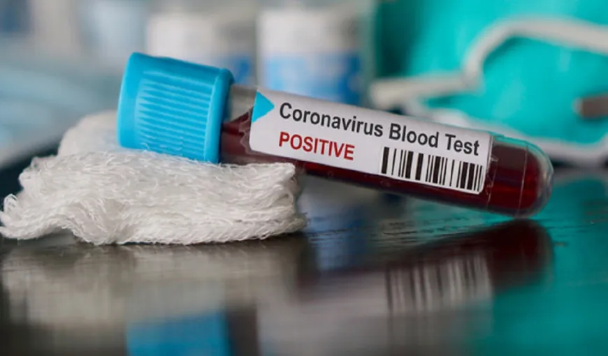 Experţii epidemiologi au veşti proaste despre cum va influenţa căldura evoluţia epidemiei de coronavirus