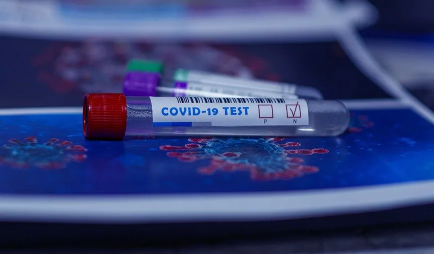 A fost creat primul test capabil să precizeze gradul imunităţii pacienţilor vindecaţi de coronavirus