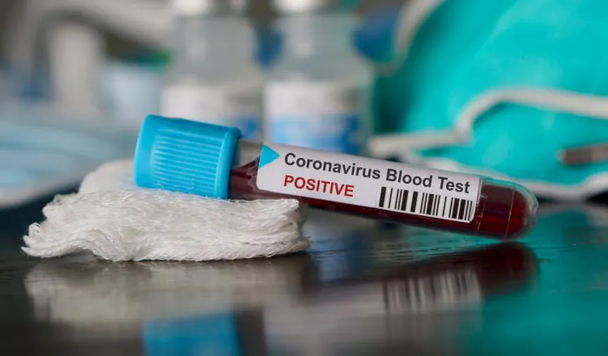 Tătaru: „La 1 iunie va începe un studiu la nivel naţional pentru a afla gradul de imunizare al populaţiei la coronavirus”