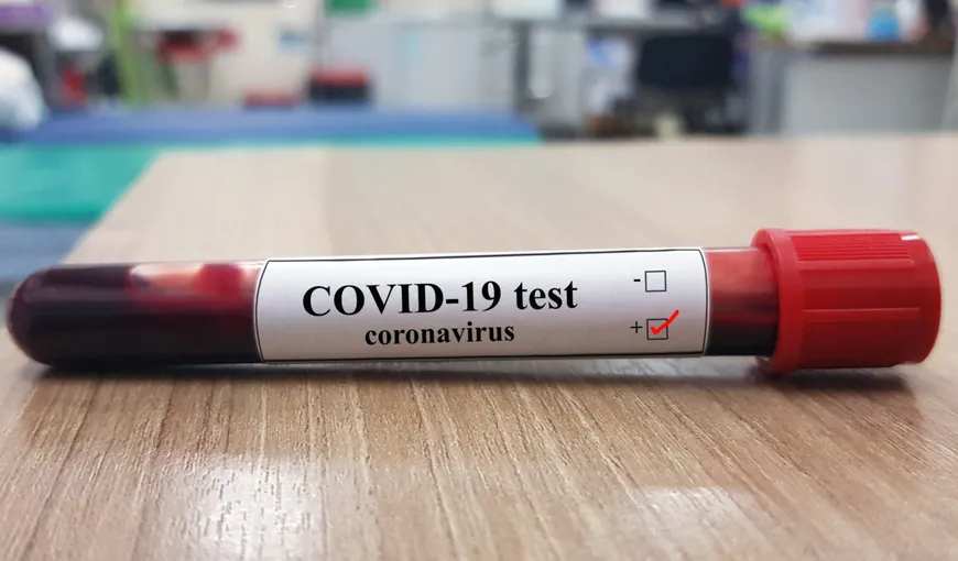 FOCAR  de coronavirus la un cămin de bătrâni