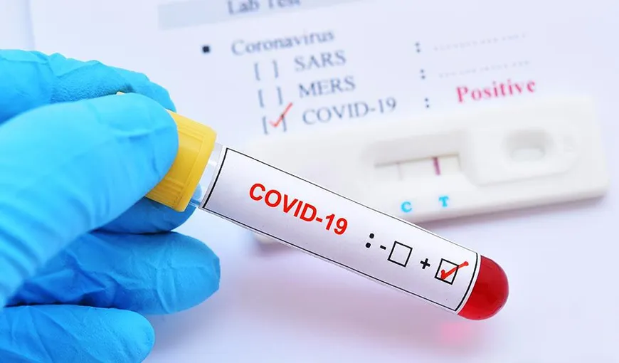 BILANŢ COVID-19 la 12 iulie în România. 456 de cazuri noi de coronavirus. 243 de pacienţi sunt la Terapie Intensivă