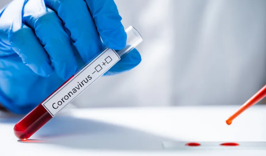STS intenționează să-și facă propriul laborator PCR pentru identificarea infectării cu COVID-19 a angajaților instituției