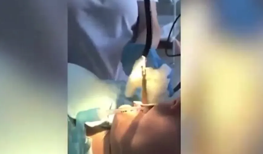 Imagini care te vor face să tresari! O femeie a ajuns la spital după ce un şarpe i-a intrat în gât
