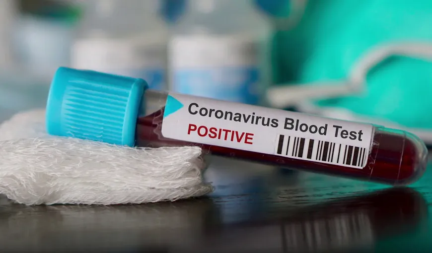 Un angajat al Ambasadei României la Londra şi unul al Centralei MAE, depistaţi pozitiv cu coronavirus