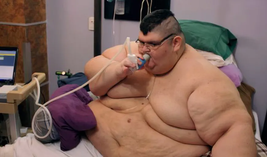 Cel mai gras om din lume s-a vindecat de COVID-19. Ajunsese la 595 KG şi suferea de multiple COMORBIDITĂŢI