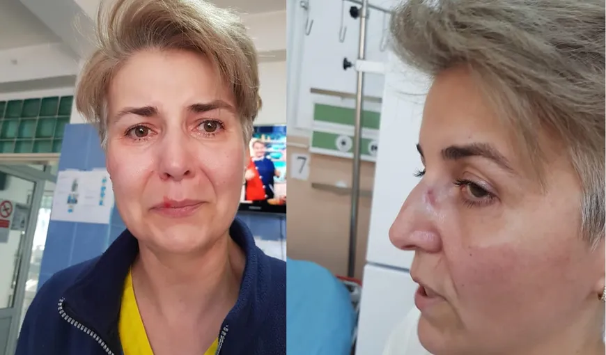 FOTO O asistentă de la ATI Giurgiu, bătută cu bestialitate în spital, din gelozie: „Am fost agresată sub privirile medicului”