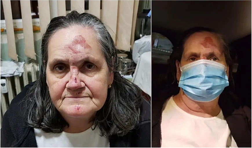 Bătrână infectată cu coronavirus, prăbuşită şi lovită la cap în faţa Spitalului Universitar din Bucureşti: „A fost umilită de cadrele medicale”