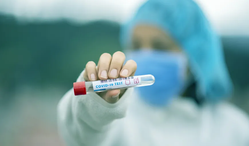 Cât costă testul RT-PCR pentru detectarea infecţiei cu coronavirus