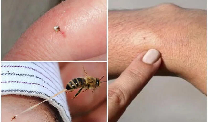 Ce faci dacă te înţeapă o albină. 10 lucruri care vă pot salva viața. Ce să (NU) faci în astfel de situații