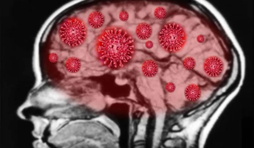 Anticorpi „defecţi” ar putea afecta creierul tinerilor, în timpul infecţiei cu Covid. Ei dezvoltă paranoia, delir şi gânduri suicidare