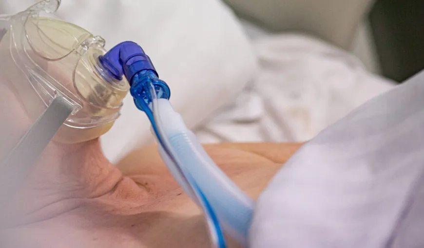 Oxigenul tehnic va fi utilizat în continuare ca soluție de rezervă, în cazul pacienților Covid