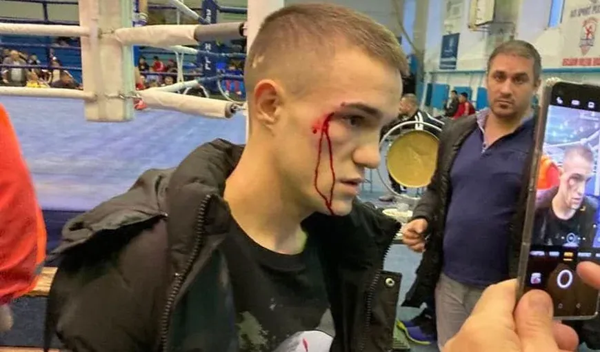 Campion național de box, bătut crunt de un antrenor! De la ce a plecat totul şi ce riscă agresorul VIDEO