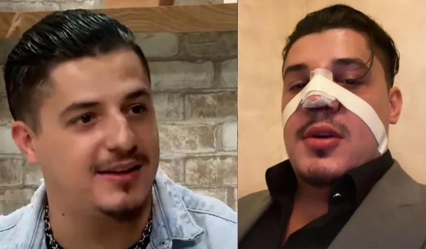 Bogdan de la Ploiești a apărut cu nasul bandajat pe aeroport. Ce a pățit celebrul manelist VIDEO