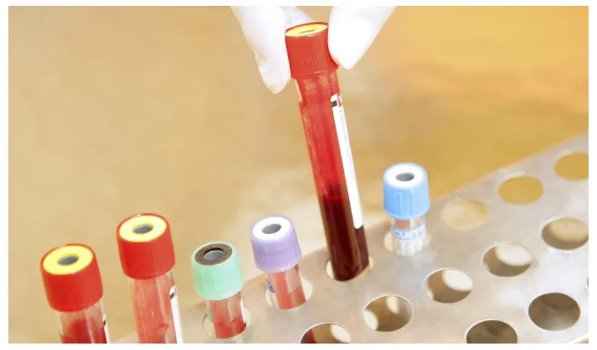 Microparticule de plastic, găsite în sângele uman. Descoperirea uluitoare a oamenilor de ştiinţă