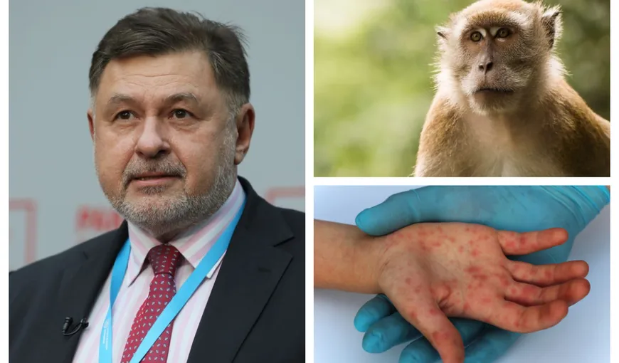 Alexandru Rafila, despre variola maimuţei: Vaccinarea nu este recomandată ca şi vaccinare de masă