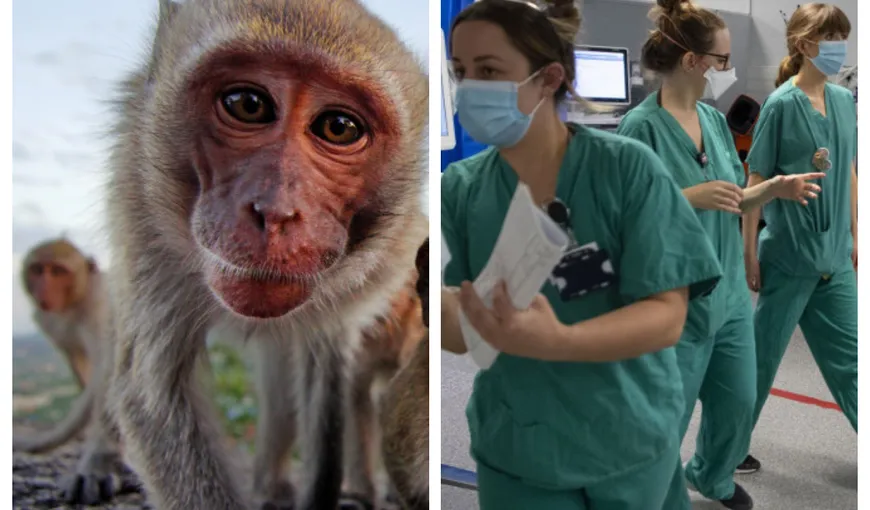 Al patrulea caz de variola maimuţei în România. Este contact cu primul pacient
