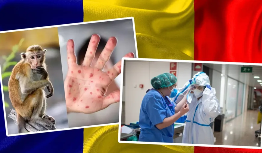 Al treilea caz de variola maimuței a fost diagnosticat în România