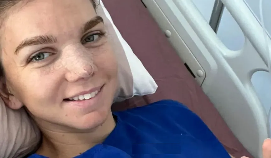 Cât a plătit Simona Halep pentru operaţia estetică de la nas. Ce presupune metoda inovatoare la care a apelat fostul nr. 1 WTA