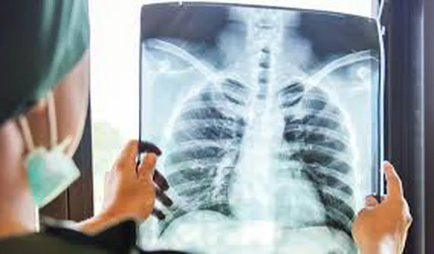 Alertă medicală în România, sunt afectaţi mai ales copiii: „La pneumologie, aproape omul şi masca de oxigen”