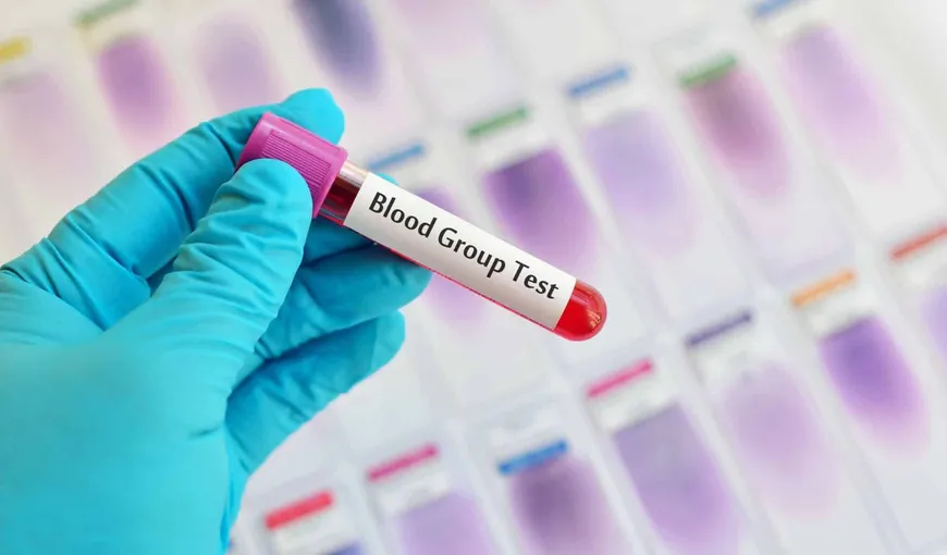 S-a descoperit o nouă grupă sanguină. Sunt doar 13 oameni în lume care au grupa Er