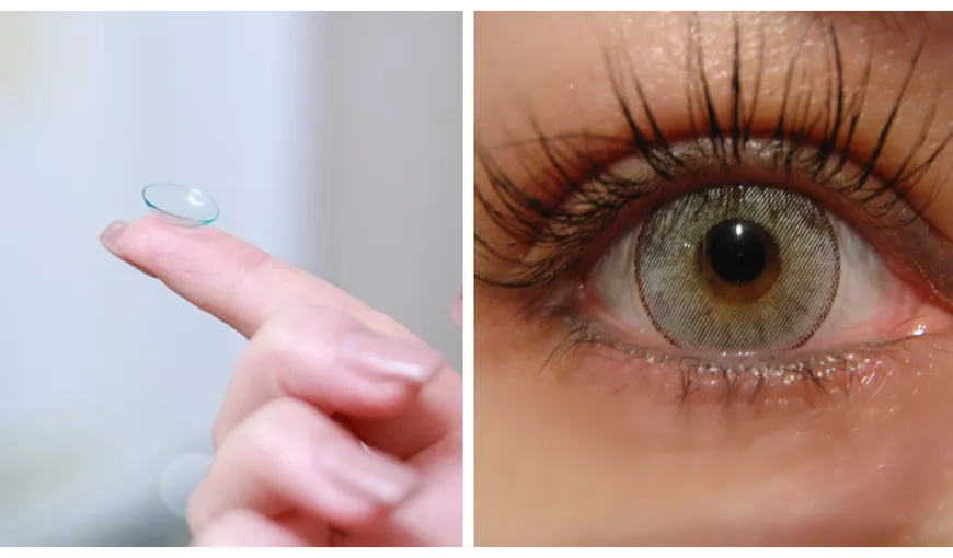 HALUCINANT! O femeie a uitat 23 de lentile de contact într-un ochi. Care este starea ei de sănătate