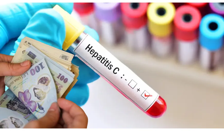 Anunț de ultimă oră despre fondurile alocate pentru bolnavii de hepatita C. Ministru: „Banii nu sunt o problemă, dar trebuie duşi acolo unde au o eficienţă”