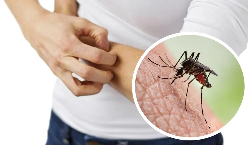 10 motive pentru care suntem ciupiți de țânțari. Dacă ți se pare că ești ținta ciupiturilor mai des decât alte persoane, iată explicația