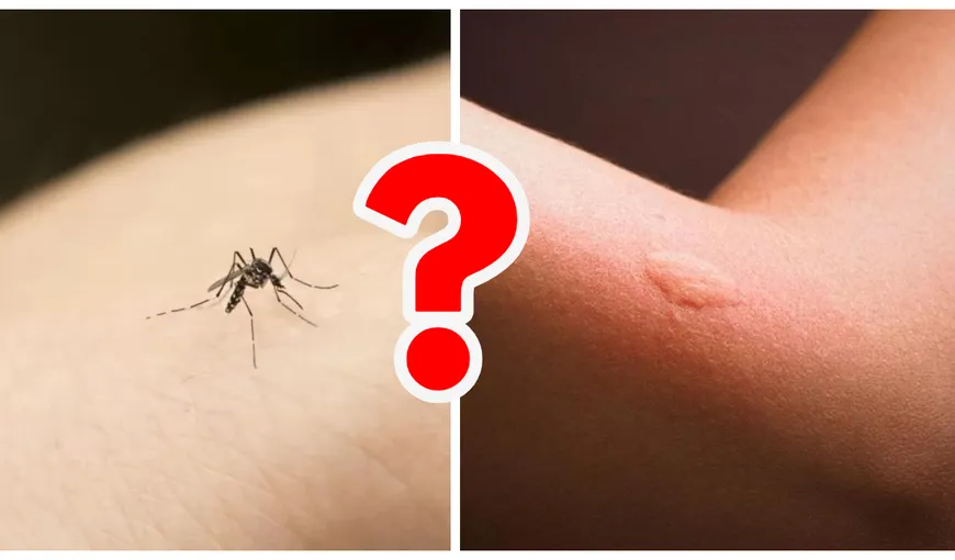 Iată un truc genial care te va scăpa de țânțari. Cu siguranță ai deja în casă toate lucrurile de care ai nevoie