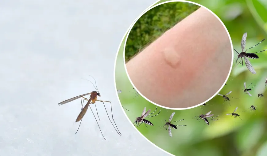 De ce unele persoane sunt pișcate mai des de țânțari decât altele. Verdictul medicului