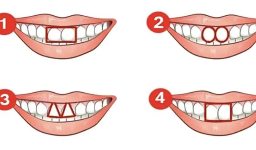 Test de personalitate. Ce spune despre tine forma dinților pe care o ai. Află ce tip de personalitate ai