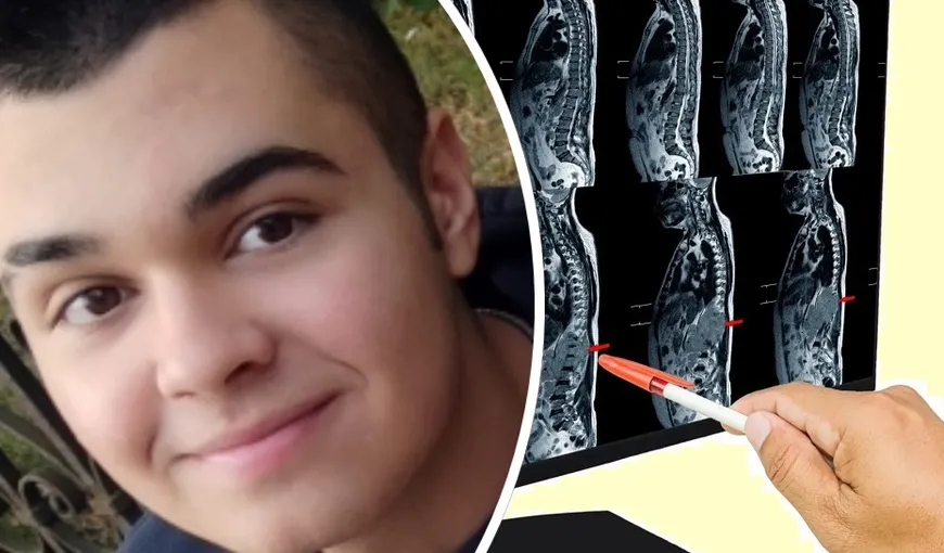 La 16 ani, Darius suferă de o afecțiune rară care-i afectează coloana. O operație revoluționară care se face doar în Londra este singura șansă a adolescentului la o viață normală