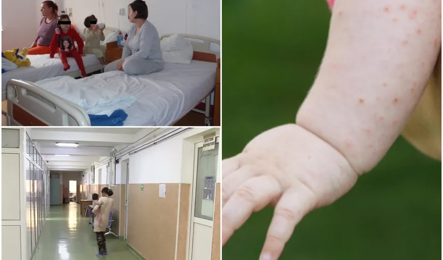 Primul deces de rujeolă din acest sezon în România. Victima, un bebeluș de 7 luni, a contractat virusul de la frățiorul lui care nu fusese vaccinat ROR