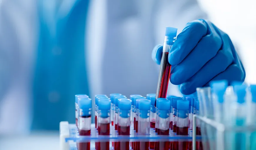 Testele de sânge pentru depistarea cancerului colorectal ar putea extinde opţiunile de screening